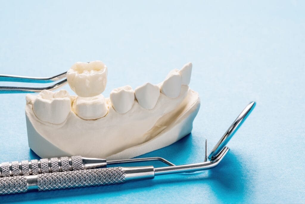 Dental tools beside a dental model showing a tooth crown being placed with tweezers on a blue background.